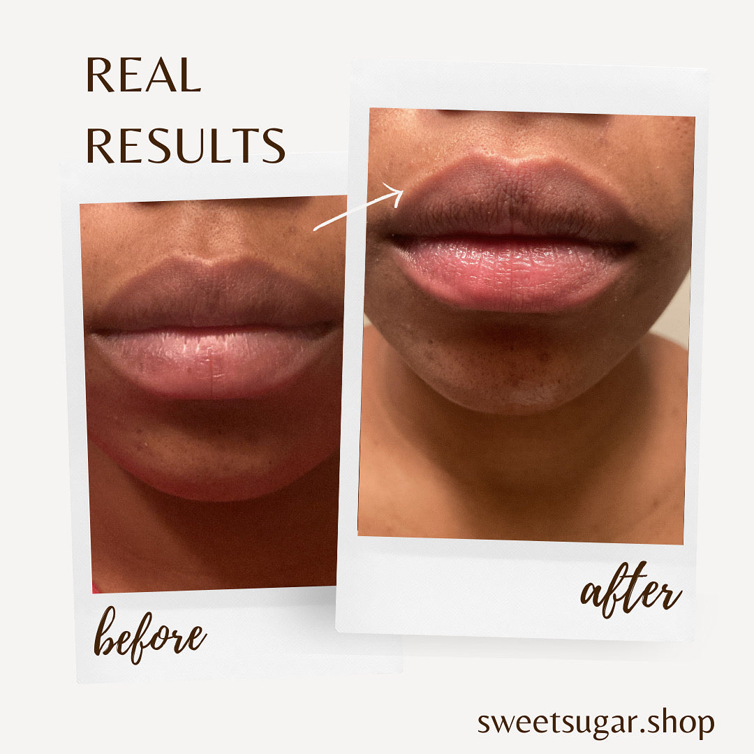 Turmeric Sugar Lip Butter Scrub